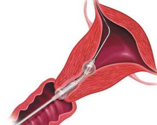 香港验血几周知道_贵阳胎儿dna亲子鉴定_性别鉴定该如何预约