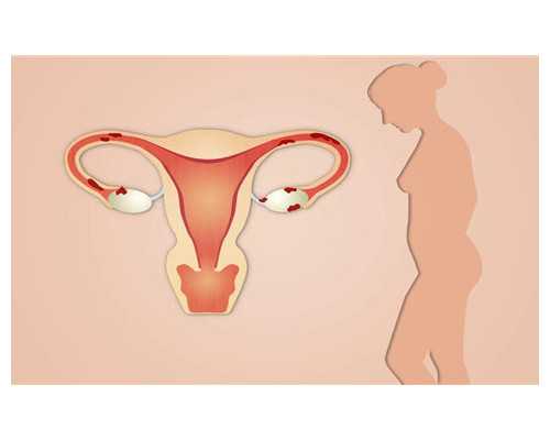 立式液下泵_2015年乾隆五彩瓷器价格是多少?