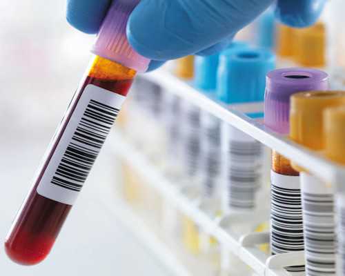 香港验血女宝做掉了_孕七周查血验男女准确吗？原来你不知道的还有这么多！