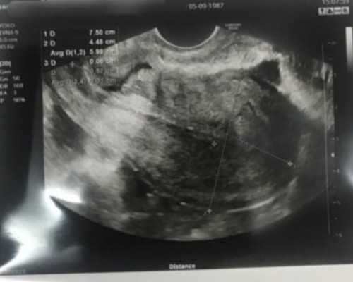 香港验血6周测男女吗_香港验血六周准确率_验血查性别真的靠谱吗!