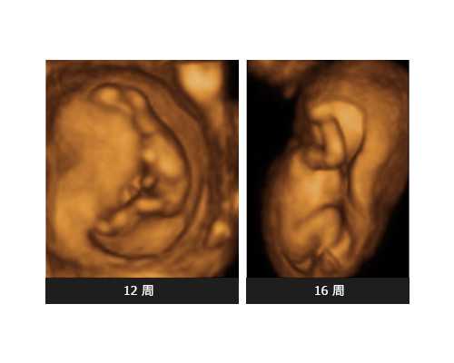 混凝土输送泵有哪几种_牛肉粉丝煲