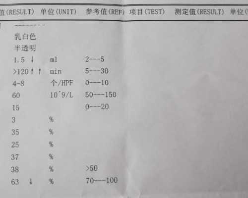 高压柱塞泵型号及参数大全_“鸡票”刚开印 预售价已飞天
