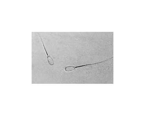 香港那个网站验血知道男孩女孩_在香港查男女查2次,DNA检测都需要哪些条件