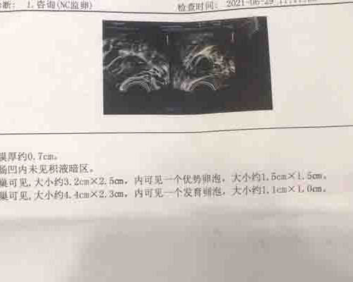 香港7天验血准吗_香港安梦验血_验血查男女需要注意什么