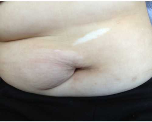 香港验血图片男孩图片_福建香港验血的中介_查男女医院机构检测中心哪家好