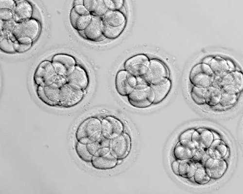 香港验血鉴男女原理_中介香港性别鉴定准吗,验血查男女需要多少钱