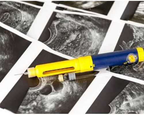 寄去香港验血测男女要多久出结果_4个月去香港查性别_抽血鉴定性别要多少费用