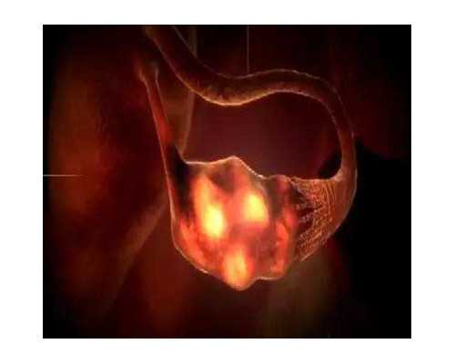 香港验血当天需要b超吗_香港验血查男女机构哪个好,靠不靠谱亲生经历告诉你