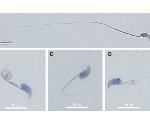 6周可以去香港验血准吗_香港那家验血生男女准_有没有香港验血翻盘的!