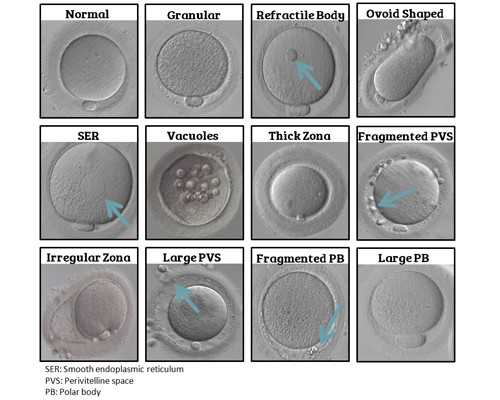 香港邮寄验血出错_我去香港验血查男女性别的经历,有需要的姐妹可以看看