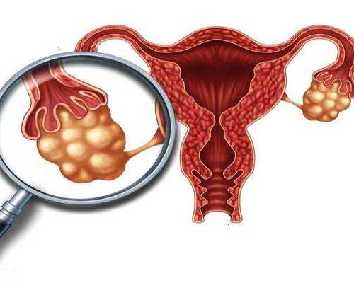 艾司洛尔泵入_美术批评谁失语?