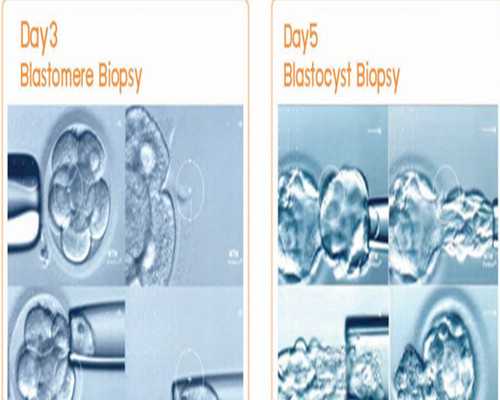 叶片式泵的特点_凉拌蒜泥茄子