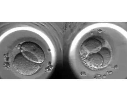 香港健达验血中心_香港医院查男女流程_怎么选择权威的验血机构!