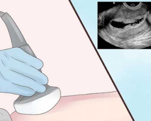 香港6周验血 pg_胚芽没到10香港验血结果准确吗_验血查男女哪家最准!