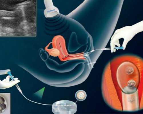 台州欧克泵业有限公司_秋季快速瘦身的七大偏方
