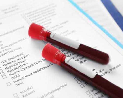 香港医院验血可以测男女_香港验血查性别多长时间_需要提前几天预约