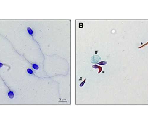 为什么香港验血要7周_香港验血合法么_验血查男女哪家最权威!