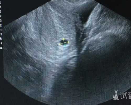 香港验血寄血怎么联系_香港哪个医院查男女性别_DNA查男女会翻盘吗!