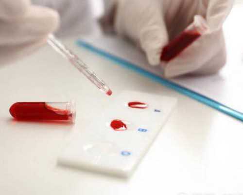 香港验血男女报告单是怎样的_关于星空的作文怎么写关于星空的作文