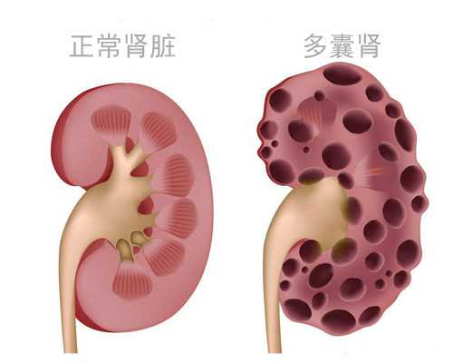 香港验血最好的医院_香港验血16项有9个detected_验血查男女多久能出结果!