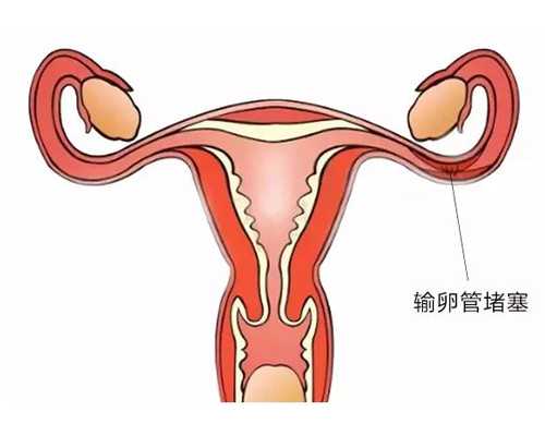 香港验血邮寄预约机构_佳肴的意思美味佳肴的意思。