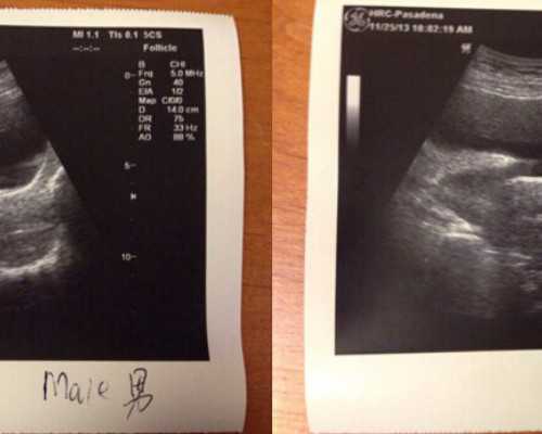 验血可以邮寄香港吗_香港母婴健康医院可以查性别吗_怎么个流程费用多少!