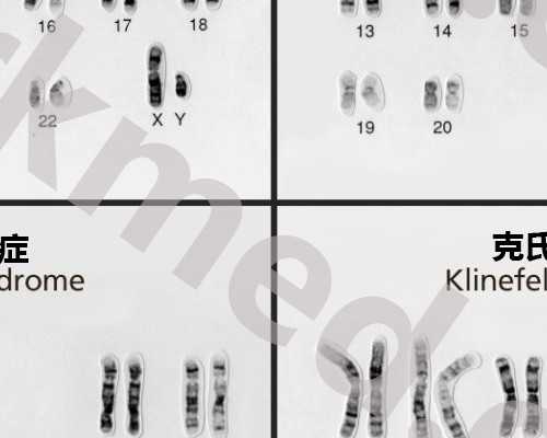 水泵参数计算_芜生：私洽，助市场恢复元气