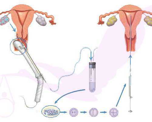 香港验血胚芽不到10mm准吗_怀孕去香港验血原来查的是Y染色体