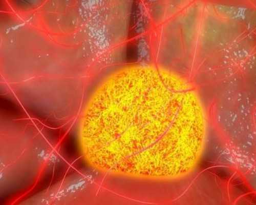 香港验血把血寄到香港会变质吗_香港验血4000港币?我来告诉你香港验血的真相