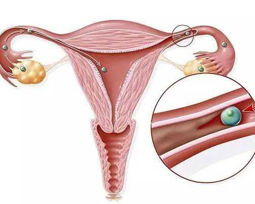 香港早孕验血有出错的吗_香港验血孕周怎么计算的_没想到这么火!