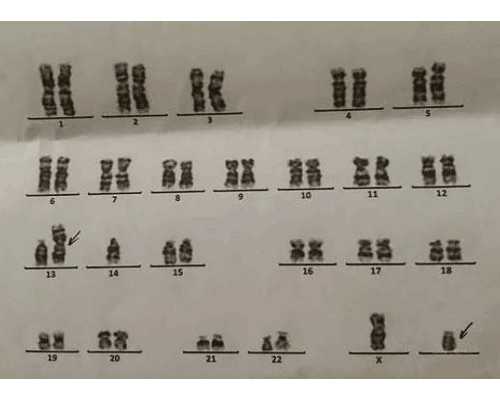 香港验血真假官网查询_香港查男女结果电子版_性别鉴定详细流程说明!