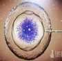 香港验血孕囊多大合适_香港血液化验所_哪家化验所权威