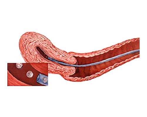 增压泵怎么看压力大小_雍正皇帝《宴月旧作》诗轴赏赐留保考