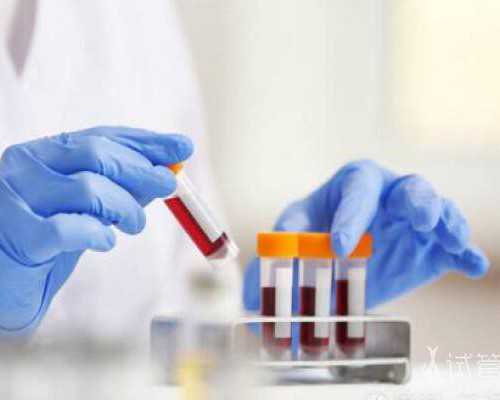 早孕香港验血报告单_香港验血检测男女流程，内地孕妈去香港验血查男女必看