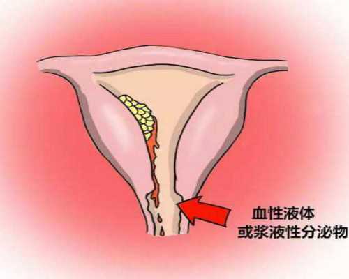 热水循环泵一直工作什么原因_水墨写意画漫谈：有附庸风雅之风