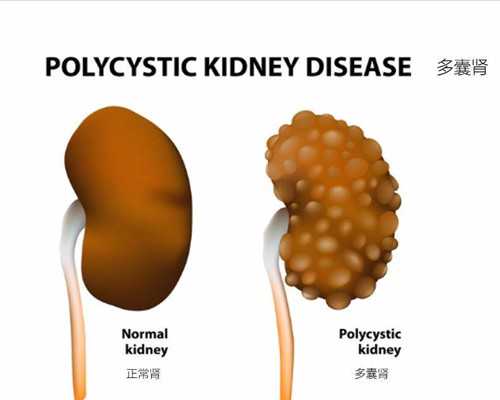 新活素静脉泵入用法用量_凤凰艺术破壳计划之“童梦仙踪——李玲个展”于1