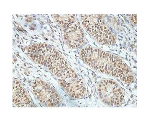 香港中介验血 报告真假_香港验血一年内没生过男孩,验血查男女是不是哄人的