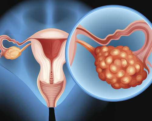 香港验血测性别分享_香港验血条件_总结下香港鉴定性别攻略