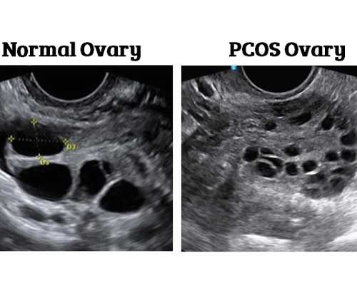 隔多久可以香港验血_五一劳动节作文600字五一节放假安排作文300个字