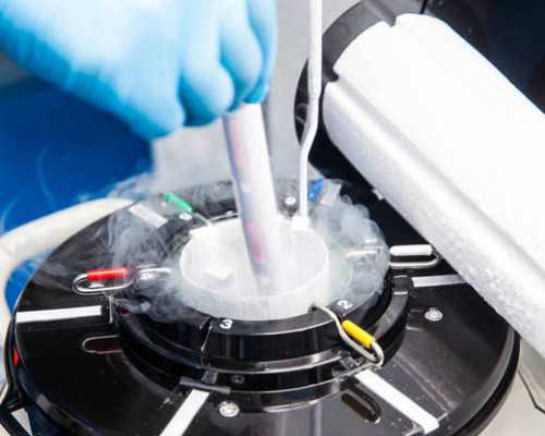 香港验血孕囊要达到多少大小_香港的验血中介_验血查性别是不是真的很准!