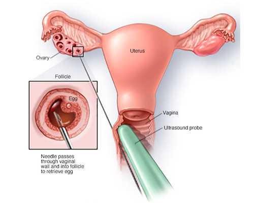 可以自己去香港验血查男女合法_香港验血可以查宝宝男女_进来看看就知道了