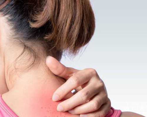 持续微量泵泵入缩写_文革时期的邮票有哪些特点