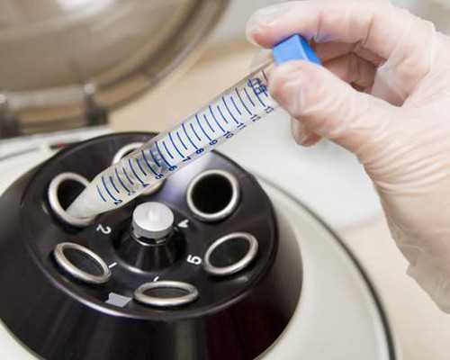 香港验血 几周 月经_香港验血16组有5组不含y_几周检测性别最准确!