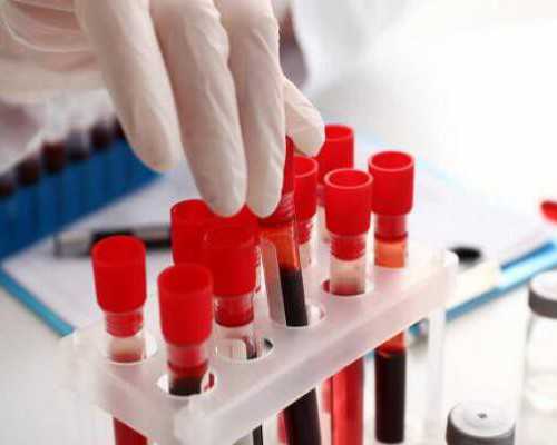 香港验血鉴定男女真假_香港验血哪家好,本人亲身经历告诉你