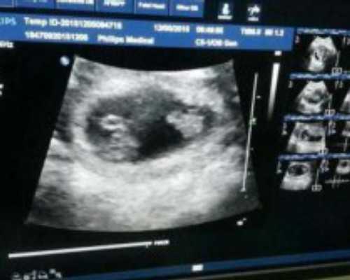 香港验血等结果忐忑中_香港pg验血报告单2121_验血查性别哪家比较好!