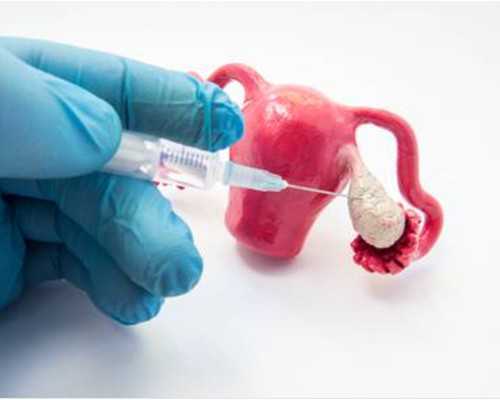 水环真空泵汽水分离器原理_中国拍卖行为何难以进入日本藏家系统？