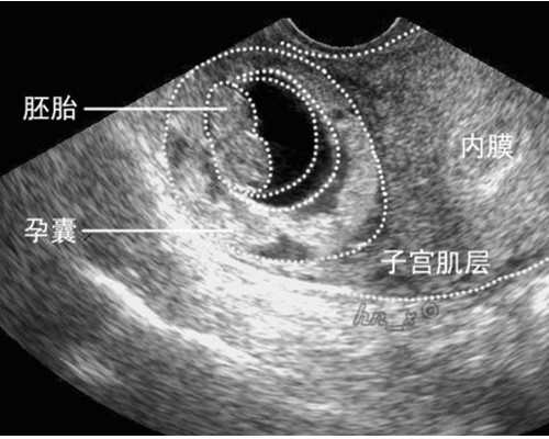 森森潜水泵hqb和hj区别_培根画画时戴的手套为什么相当于宗教圣物？