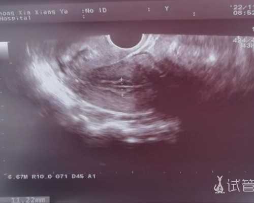 胎芽3mm去香港验血有结果吗_香港婴儿性别鉴定靠谱吗,宝妈亲身经历告诉你真相