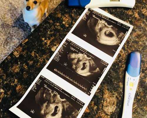 香港公立医院验血会告诉性别吗_香港验血是女孩结果生是男孩还是女孩_性别鉴