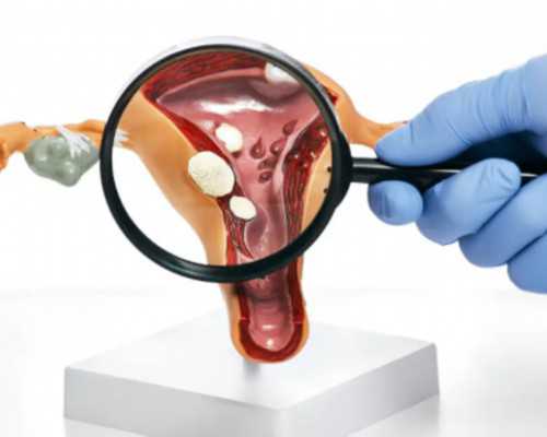 有去香港验血是女孩结果生出来是男孩的吗_香港验血Y生下后不准_怎么预约香港